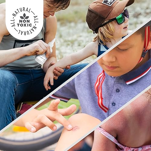 Active Skin Repair First Aid Skin Healing Burn Hydrogel - Natural, Non-Toxic, & No Sting Skin Burn Ointment with Hypochlorus Acid for Immediate Pain Relief, HSA/FSA Eligible, 3 oz - Poueer